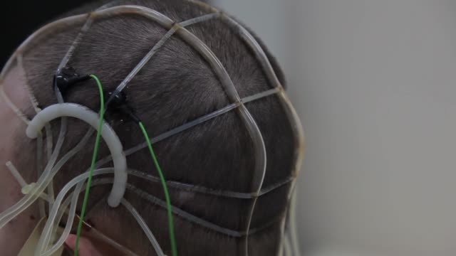 The-doctor-connects-the-electronic-sensors-to-the-patient's-head.-Progressive-medical-technologies.-Nanotechnology-4K