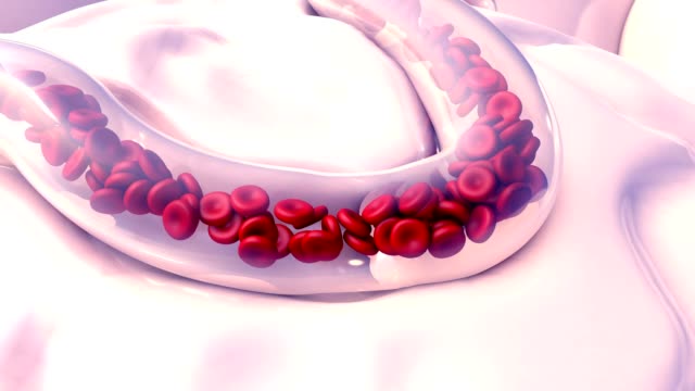 Blutgerinnseln-in-Blutgefäßen