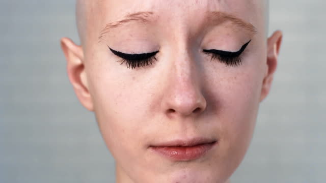 Portrait-of-a-sad,-depressed-woman-suffering-from-cancer-looking-into-the-camera