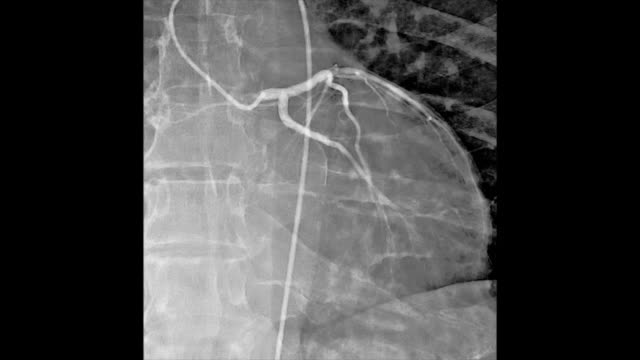 Herz-Kreislauf-Angiographie