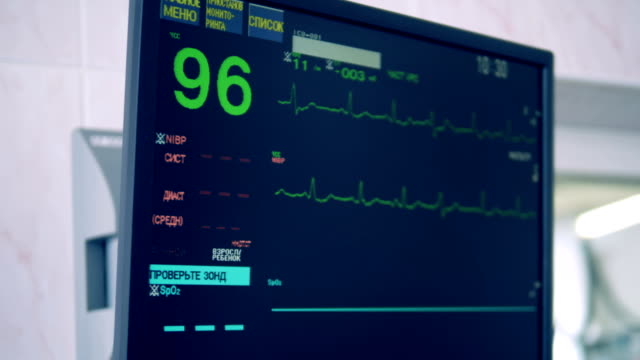 Especial-monitor-muestra-la-condición-del-corazón-durante-una-cirugía.-4K.