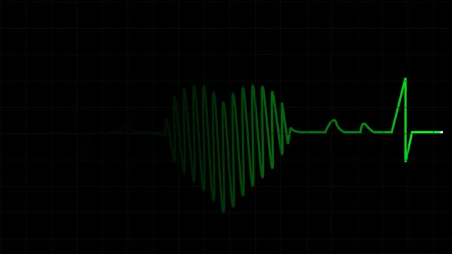 Herz-Bildung-durch-EKG-signal