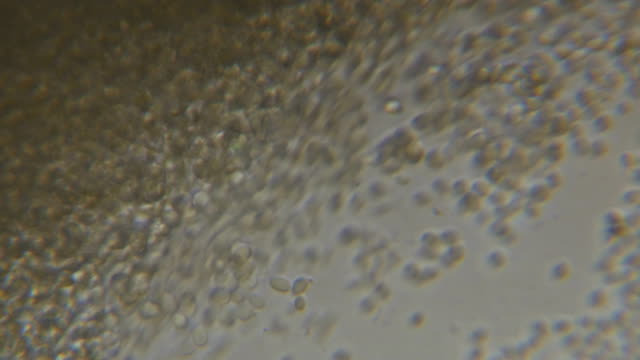 Budding-yeast-cell-under-the-microscope.
