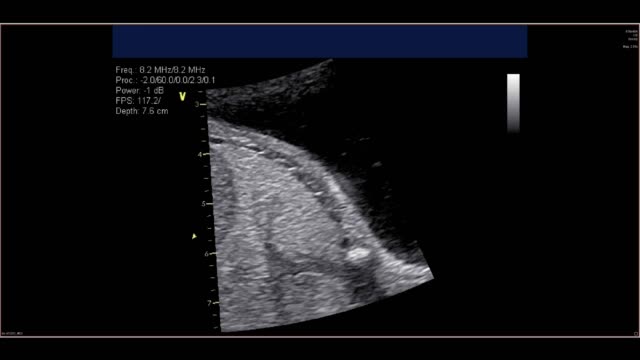 Ecocardiografía-fetal