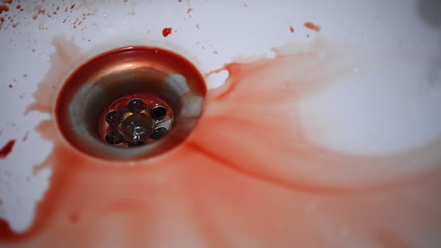 Tropfen-von-Blut-befleckt-am-Waschbecken