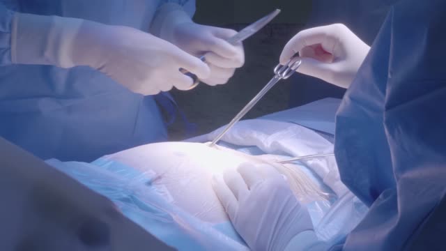Equipo-médico-realizar-la-operación-quirúrgica-en-quirófano-moderno-brillante.
