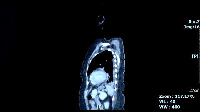 Body-inside-scan-image
