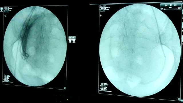 Am-Leben-weibliche-Brust-auf-einem-kreisförmigen-blauen-Bildschirm-einer-modernen-Röntgen-Appliance