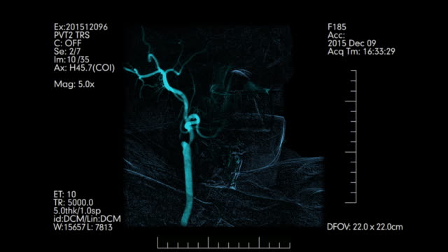Medical-monitoring-of-brain-blood-vessels.-Cerebral-angiography.