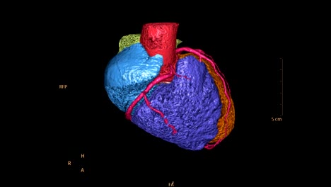 CTA-Coronary-artery-colorful-3D-rendering-image.-CT-angiographphy-for-heart-disease-.