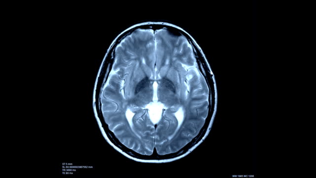 Brain-scan-image