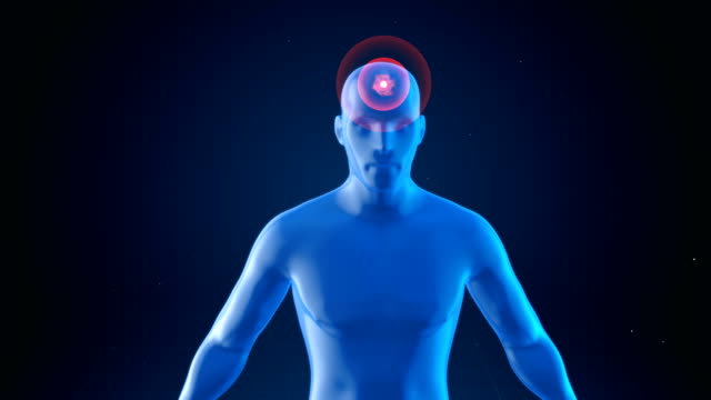 Modell-eines-Mannes-mit-Impulsen-von-Kopfschmerzen,-medizinisches-Konzept