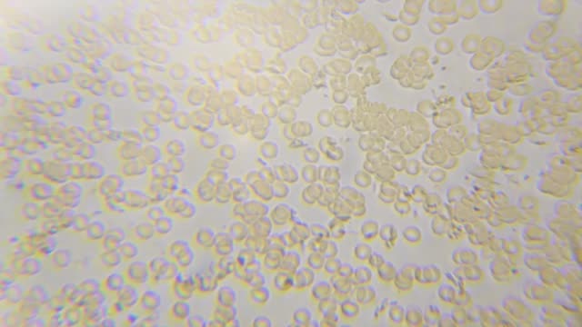 Lapso-de-tiempo-de-glóbulos-rojos-humanos-coagulación-/-formando-un-coágulo,-a-través-de-microscopio,-mudanza,-ampliada-400-veces