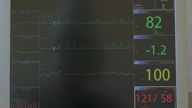 El-monitor-se-encuentra-en-la-sala-de-operaciones,-muestra-el-estado-del-paciente-en-el-momento-de-la-cirugía
