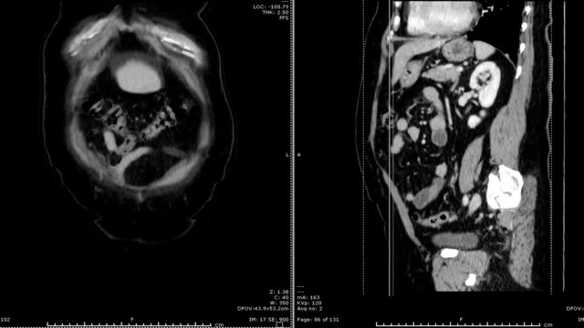 CT-scan-/-CTA-abdominal-aorta.-medical-technology-concept.