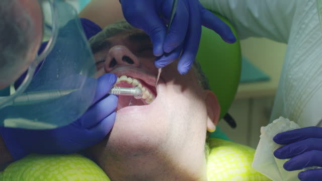 Behandlung-von-Zahnschmerzen-in-Zahnarztpraxis.-Zahnarzt-Bohren-kranken-Zahn-hautnah