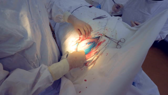 Cirujano-termina-cirugía-de-abordaje.-Médico-desinfecta-sutura-médica.