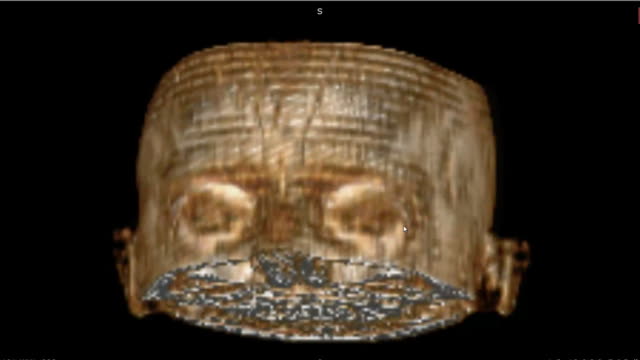 CT-Scan-mit-3D-Bild-des-normalen-menschlichen-Schädel-für-Prüfung