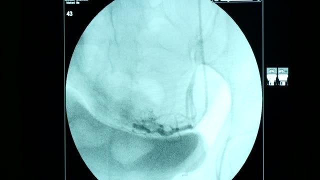 Atmung-die-Brust-einer-Frau-auf-einem-runden-blauen-Bildschirm-eine-erweiterte-Röntgengerät
