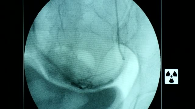 Eine-Atmung-weibliche-Brust-auf-einem-großen-blauen-Bildschirm-von-einem-modernen-Röntgengerät