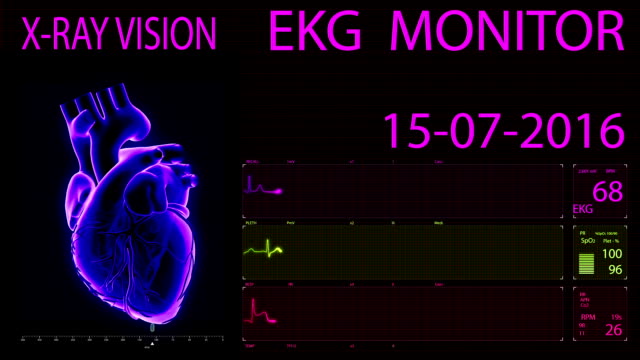 EKG-Monitor-animierte-Herzen