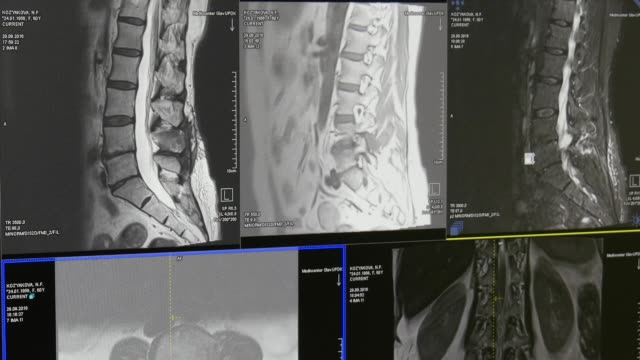 Médula-espinal-y-columna-vertebral-tomografía-de-resonancia-magnética.