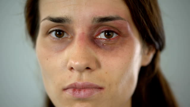 Hurt-lady-crying,-bruised-face-close-up,-domestic-violence-issue,-awareness