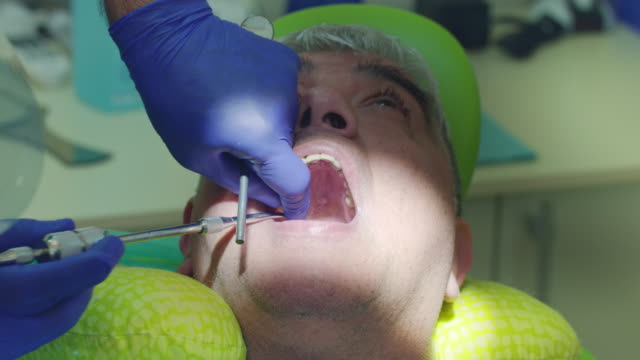 Proceso-de-eliminación-de-caries-dental.-Cerca-de-las-manos-del-dentista-quitar-diente-enfermo