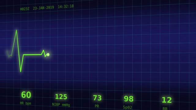 Heart-beat-chart-on-the-monitor-7