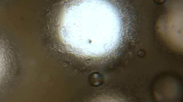 Célula-de-levadura-de-florecimiento-bajo-el-microscopio.