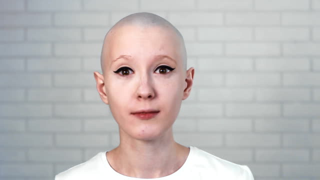 Retrato-de-una-mujer,-triste,-deprimida,-sufre-de-cáncer-mirando-a-la-cámara