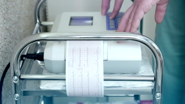 Des-Arztes-Hände-verbundenen-Elektroden-für-EKG