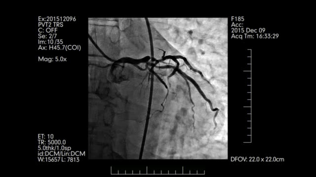 Herz-Kreislauf-Angiographie-Prüfung-Display-mit-medizinischen-Informationen