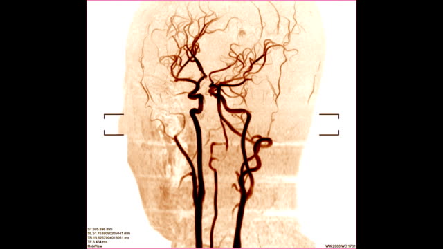 Blutgefäße-Scan-Bild
