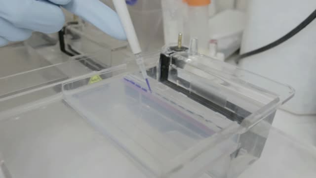 Ein-handheld-Schuss-eines-Forschers-Pipettieren-der-Proben-zu-einem-Eletrophoresis-Gel-in-einem-genetischen-Labor-an-der-Universität