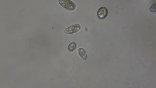 Bewegung-der-einzelnen-celled-Tiere-(Infusorien)-unter-Mikroskop.-Kolonie-von-Ciliaten-Stylonychia-unter-dem-Mikroskop-in-Seewasser.-Hautnah.-UHD-4K