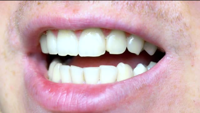 Primer-plano-de-los-dientes,-dientes-astillados