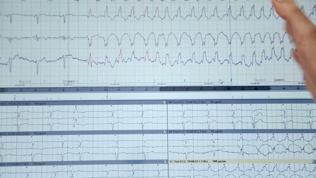 Cardiac-heart-disease-on-a-computer-close-up