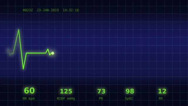 Herzschlag-Diagramm-auf-dem-Monitor-6