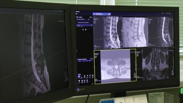 Arzt-macht-Rückenmark-und-Wirbelsäule-Tomographie-im-MRI-scan.