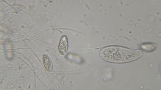 Bewegung-der-einzelnen-celled-Tiere-(Infusorien)-unter-Mikroskop.-Kolonie-von-Ciliaten-Stylonychia-unter-dem-Mikroskop-in-Seewasser.-Hautnah.-UHD-4K
