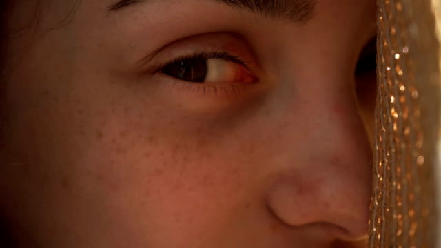 the-eyes-of-a-young-girl-with-freckles-on-her-face-close-up