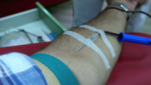 At-the-transfusion-department,-a-person-donating-blood