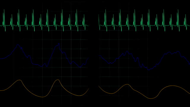 Simulation-der-Herzfrequenz-medizinische-Maschine