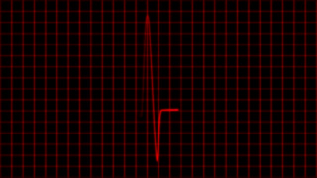 Kardiogramm-Cardiograph-Oszilloskop-Bildschirm-Schleife-4k
