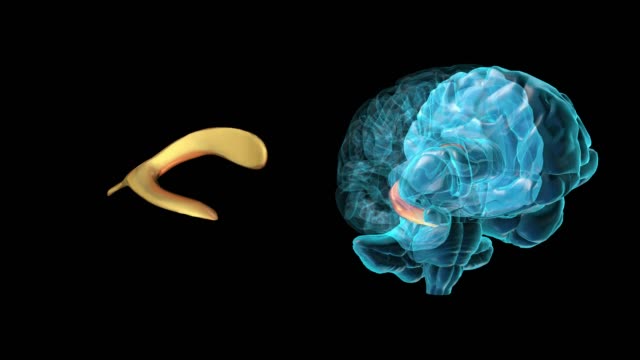 Gehirn-rechts-lateralen-Ventrikel