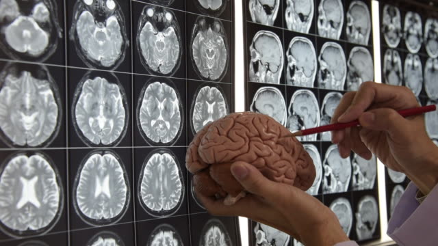 Doctor-demonstrating-brain-anatomy