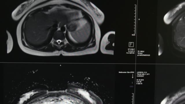 Gehirn-Tomographie-auf-professionelle-medizinische-Ausrüstung-MRT-Untersuchung.