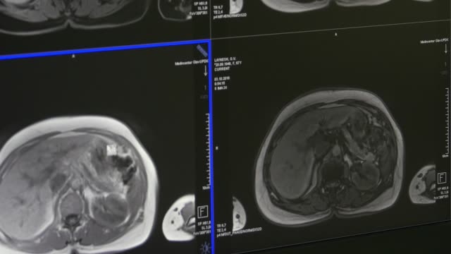 Gehirn-Tomographie-MRI-Scan-Professional-medizinische-Geräte.