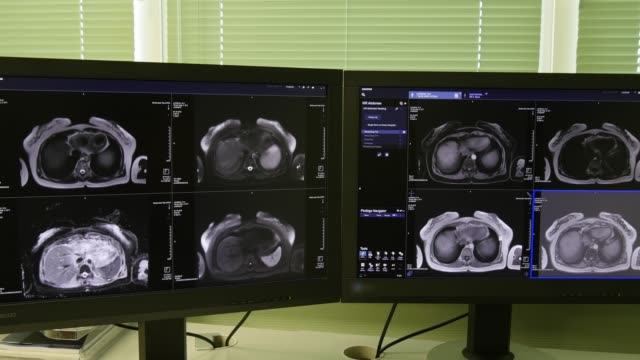 Tomografía-de-cerebro-en-la-exploración-de-MRI.